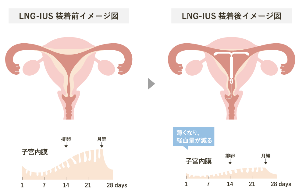 装着イメージ図