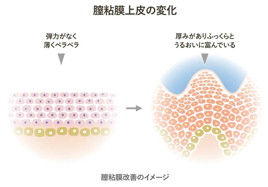 モナリザタッチの効果