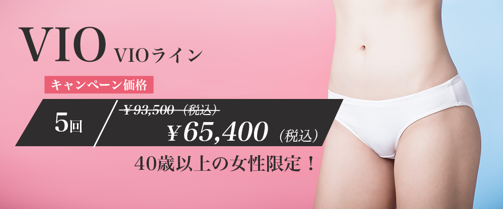 VIOライン